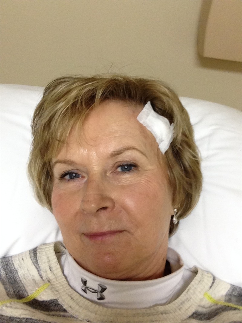 2014-03-05 11-45-59 Basal Cell Carcinoma surgery.jpg